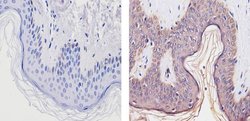 Invitrogen THRA Polyclonal Antibody 200 &mu;g; Unconjugated:Antibodies,