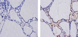 Invitrogen THRA Polyclonal Antibody 200 &mu;g; Unconjugated:Antibodies,