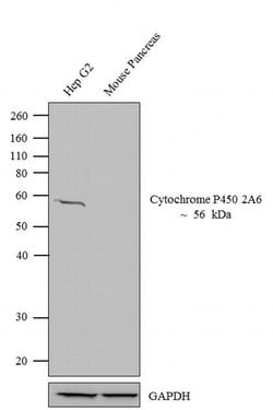 Invitrogen CYP2A6 Polyclonal Antibody 100 &mu;L; Unconjugated:Antibodies,