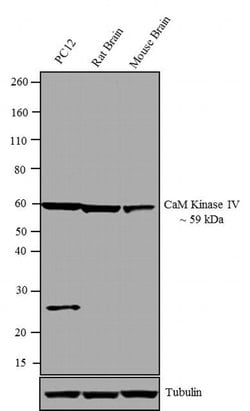 Invitrogen CaMKIV Polyclonal Antibody 100 &mu;g; Unconjugated:Antibodies,