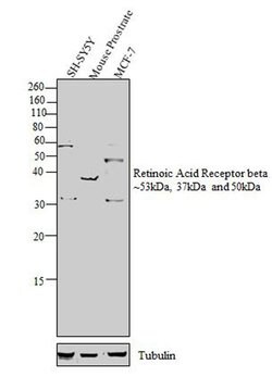 Invitrogen RARB Polyclonal Antibody 100 &mu;L; Unconjugated:Antibodies,