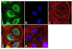 Invitrogen RARB Polyclonal Antibody 100 &mu;L; Unconjugated:Antibodies,