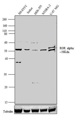 Invitrogen RORA Polyclonal Antibody 100 &mu;g; Unconjugated:Antibodies,