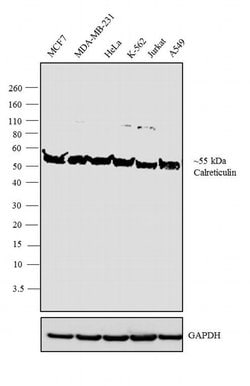 Invitrogen&trade;&nbsp;Calreticulin Polyclonal Antibody