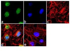 Invitrogen TRAIL-R2 (DR5) Polyclonal Antibody 100 &mu;g; Unconjugated:Antibodies,