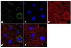 Invitrogen PSMA1 Polyclonal Antibody 100 &mu;g; Unconjugated:Antibodies,
