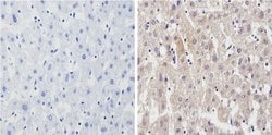 Invitrogen Cyp4a10 Polyclonal Antibody 100 &mu;L | Buy Online | Invitrogen&trade; | Fisher Scientific