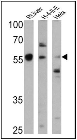 Invitrogen Cyp4a10 Polyclonal Antibody 100 &mu;L | Buy Online | Invitrogen&trade; | Fisher Scientific