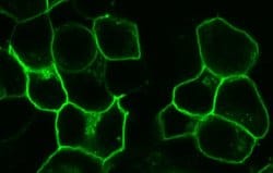 Invitrogen™ GPR20 Polyclonal Antibody