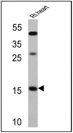 Invitrogen ANP Polyclonal Antibody 100 &mu;L; Unconjugated:Antibodies,