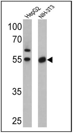PPAR alpha/gamma Polyclonal Antibody, Invitrogen 100 &mu;L; Unconjugated:Antibodies,