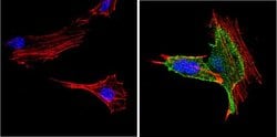 Invitrogen PPAR gamma Polyclonal Antibody 100 &mu;L; Unconjugated:Antibodies,