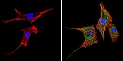 Invitrogen PPAR gamma Polyclonal Antibody 100 &mu;L; Unconjugated:Antibodies,
