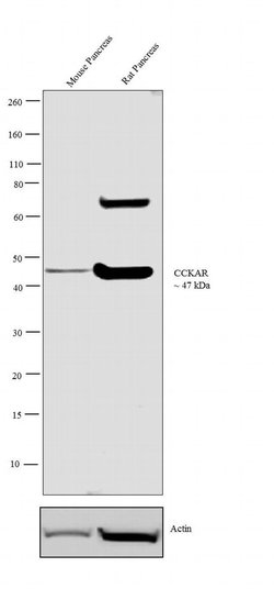 Invitrogen CCKAR Polyclonal Antibody 100 &mu;L | Buy Online | Invitrogen&trade; | Fisher Scientific