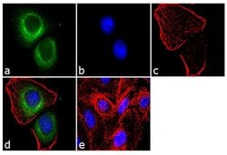 Invitrogen CCKBR Polyclonal Antibody 100 &mu;L; Unconjugated:Antibodies,
