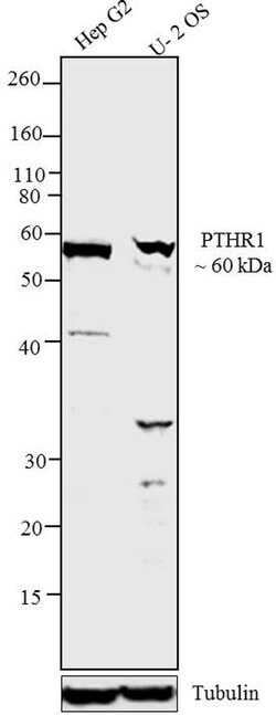 Invitrogen PTH1R Polyclonal Antibody 100 &mu;L; Unconjugated:Antibodies,