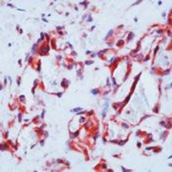 VEGF Receptor 1 Polyclonal Antibody, Invitrogen 500 &mu;L; Unconjugated:Antibodies,