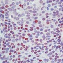 p57 Kip2 Polyclonal Antibody, Invitrogen 500 &mu;L | Buy Online | Invitrogen | Fisher Scientific