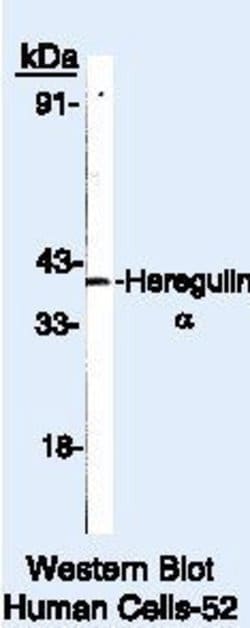 NRG1 Polyclonal Antibody, Invitrogen 500 &mu;L | Buy Online | Invitrogen | Fisher Scientific