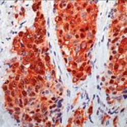 Calretinin Polyclonal Antibody, Invitrogen 500 &mu;L; Unconjugated:Antibodies,