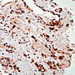 PDGFRA Polyclonal Antibody, Invitrogen 500 &mu;L; Unconjugated:Antibodies,