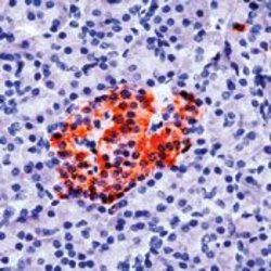 PGP9.5 Polyclonal Antibody, Invitrogen 500 &mu;L; Unconjugated:Anticuerpos