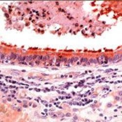 Invitrogen beta Tubulin Polyclonal Antibody 500 &mu;L; Unconjugated:Antibodies,