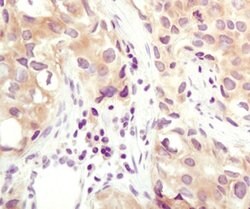 Invitrogen Calcyclin Polyclonal Antibody 100 μL; Unconjugated:Antibodies,