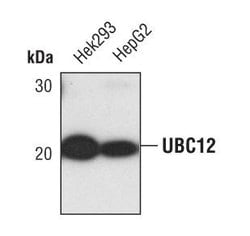 Invitrogen UBE2M Polyclonal Antibody 100 &mu;L; Unconjugated:Antibodies,