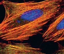 Invitrogen MYH9 Polyclonal Antibody 100 &mu;L | Buy Online | Invitrogen&trade; | Fisher Scientific