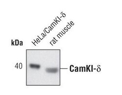 Invitrogen CAMK1D Polyclonal Antibody 100 &mu;L; Unconjugated:Antibodies,