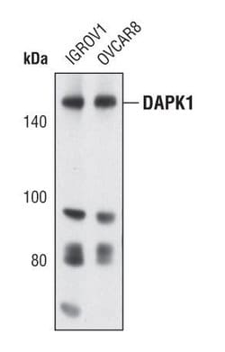 Invitrogen DAPK1 Polyclonal Antibody 100 &mu;L; Unconjugated:Antibodies,