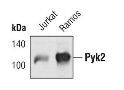 Invitrogen PYK2 Polyclonal Antibody 100 &mu;L; Unconjugated:Antibodies,
