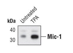 Invitrogen GDF15 Polyclonal Antibody 100 &mu;L; Unconjugated:Antibodies,