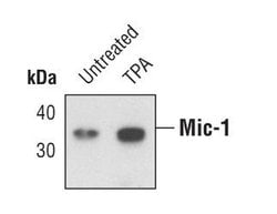 Invitrogen GDF15 Polyclonal Antibody 100 &mu;L | Buy Online | Invitrogen&trade; | Fisher Scientific