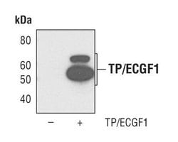 Invitrogen Thymidine Phosphorylase Polyclonal Antibody 100 &mu;L; Unconjugated:Antibodies,