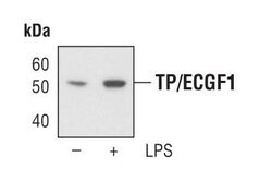 Invitrogen Thymidine Phosphorylase Polyclonal Antibody 100 &mu;L; Unconjugated:Antibodies,