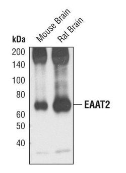 Invitrogen GLT-1 Polyclonal Antibody 100 &mu;L; Unconjugated:Anticuerpos
