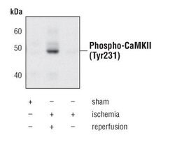 Phospho-CaMKII alpha/beta/delta (Tyr231) Polyclonal Antibody, Invitrogen