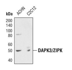 Invitrogen ZIPK Polyclonal Antibody 100 &mu;L; Unconjugated:Antibodies,