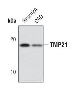 Invitrogen TMP21 Polyclonal Antibody 100 &mu;L; Unconjugated:Antibodies,