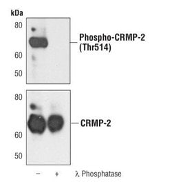 Invitrogen Phospho-CRMP2 (Thr514) Polyclonal Antibody 100 &mu;L; Unconjugated:Antibodies,