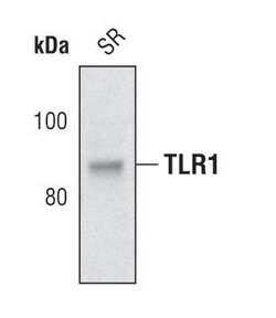 Invitrogen TLR1 Polyclonal Antibody 100 &mu;L | Buy Online | Invitrogen&trade; | Fisher Scientific