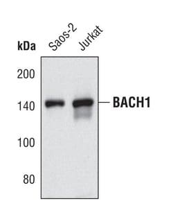 Invitrogen BRIP1 Polyclonal Antibody 100 &mu;L | Buy Online | Invitrogen&trade; | Fisher Scientific