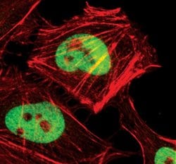 Invitrogen CTCF Polyclonal Antibody 100 &mu;L | Buy Online | Invitrogen&trade; | Fisher Scientific