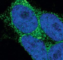 Invitrogen STIM2 Polyclonal Antibody 100 &mu;L; Unconjugated:Antibodies,