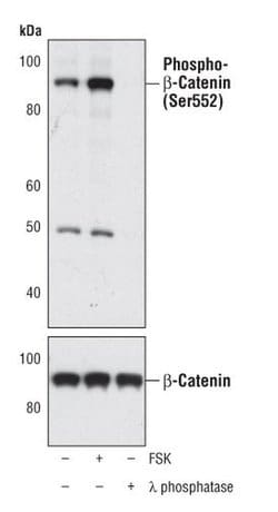 Invitrogen Phospho-beta Catenin (Ser552) Polyclonal Antibody 100 &mu;L | Buy Online | Invitrogen&trade; | Fisher Scientific