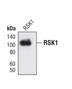 Invitrogen RSK1 Polyclonal Antibody 100 &mu;L; Unconjugated:Antibodies,