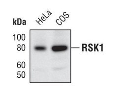 Invitrogen RSK1 Polyclonal Antibody 100 &mu;L; Unconjugated:Antibodies,