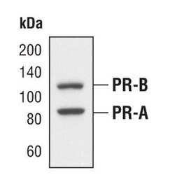 Invitrogen Progesterone Receptor Polyclonal Antibody 100 &mu;L; Unconjugated:Antibodies,